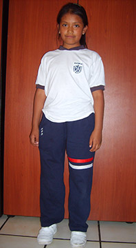 1601_Johanna_mit_Prothese-1