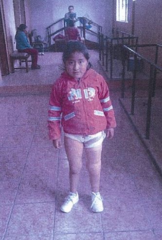 1602_Jessica_Daniela_Quinatoa_mit_Prothese