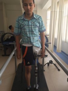 1608 Mauricio mit Prothese